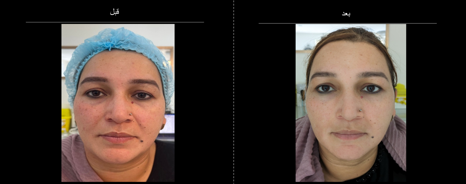 Gouri_B4_After_3 Loading image 3 ...