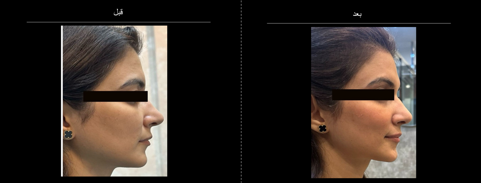 Gouri_B4_After_4 Loading image 2 ...